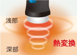 超音波はカラダの深部から温めてほぐします