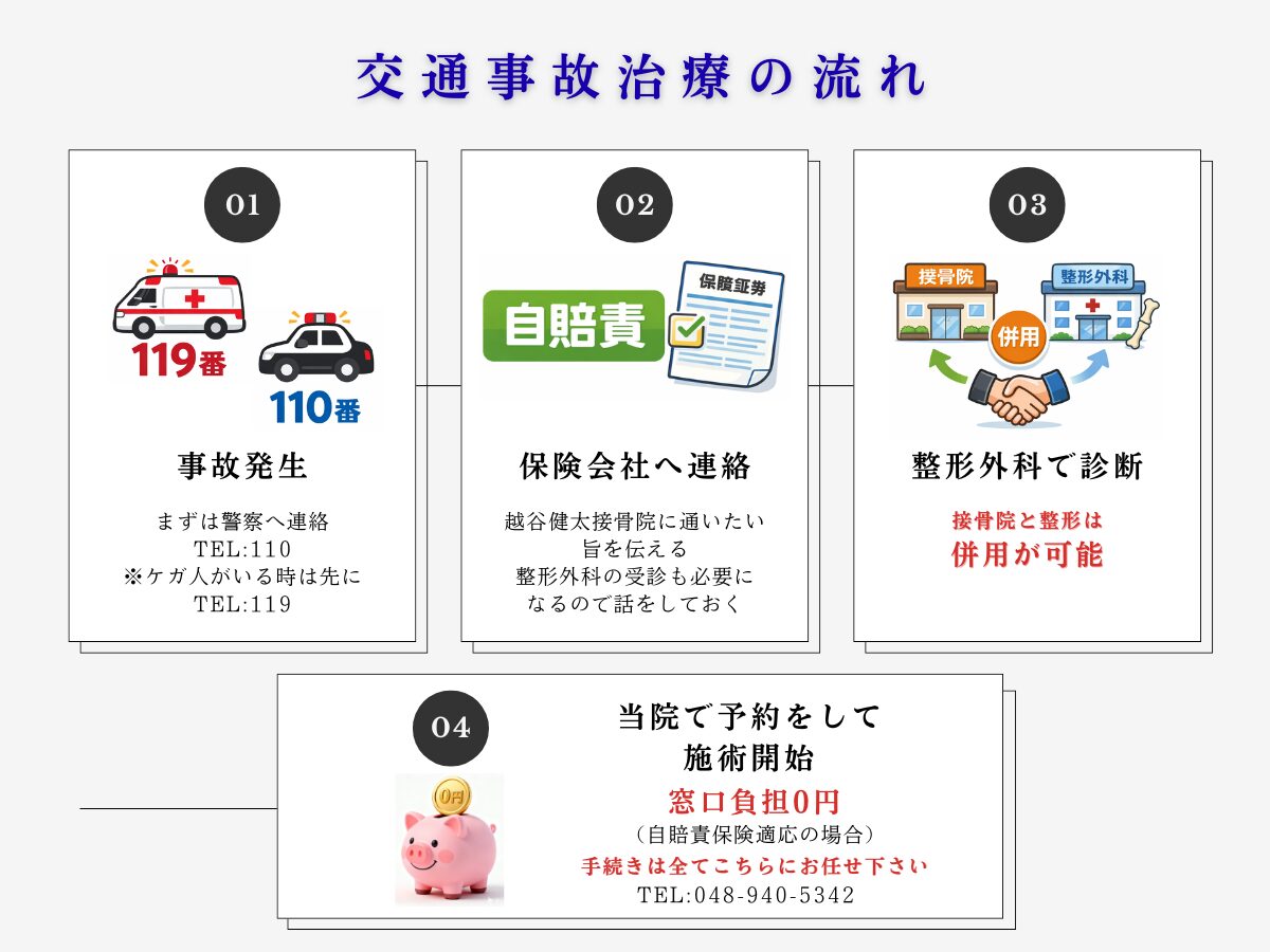 越谷市で交通事故治療を受けるまでの流れ
